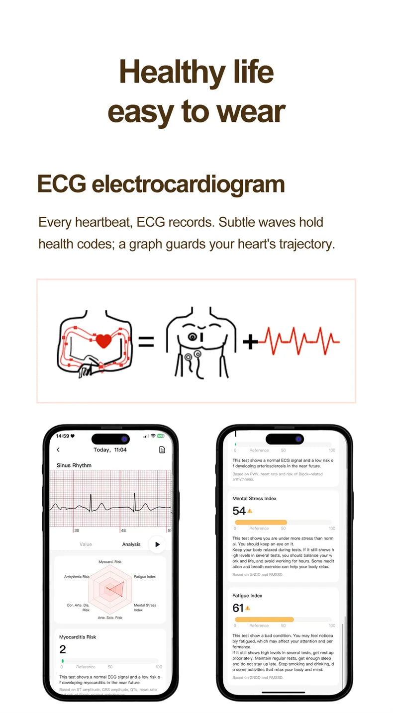 ECG Smart Watch Women 1.32inch AMOLED Screen Sport Watch Blood Pressure Micro physical examination AI dial SmartWatch For Women