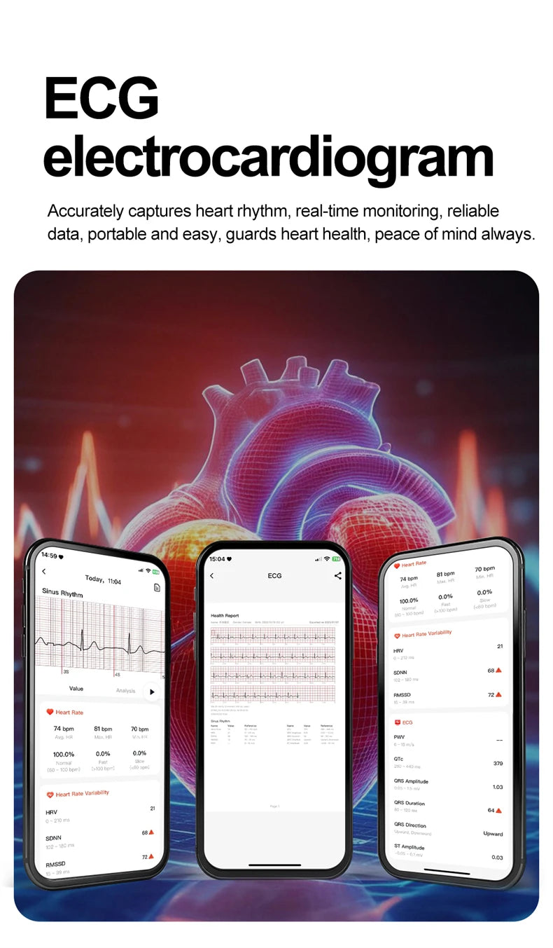 2026 New AI-GPT Health Diagosis Smart Watch Men ECG Blood Pressure Blood Oxygen Lipid Uric Acid Health Analysis Smart Bracelet